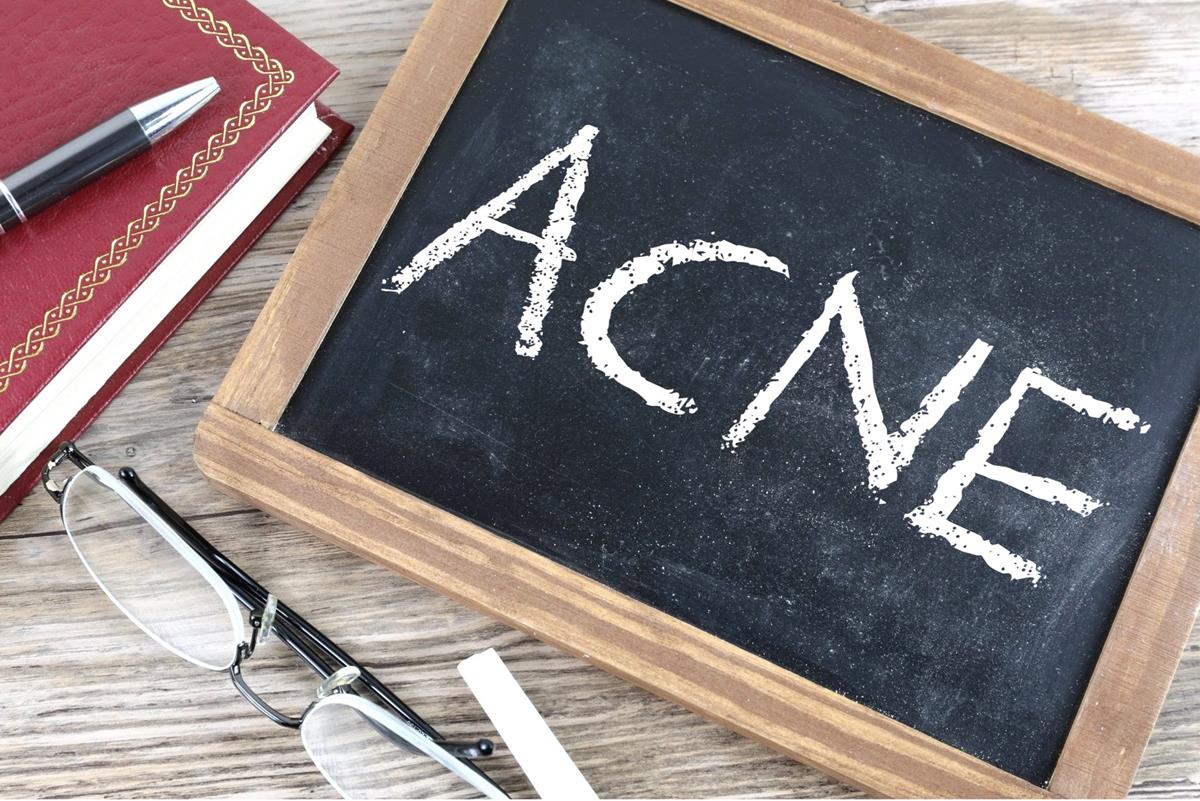 How to Prevent Acne Scars