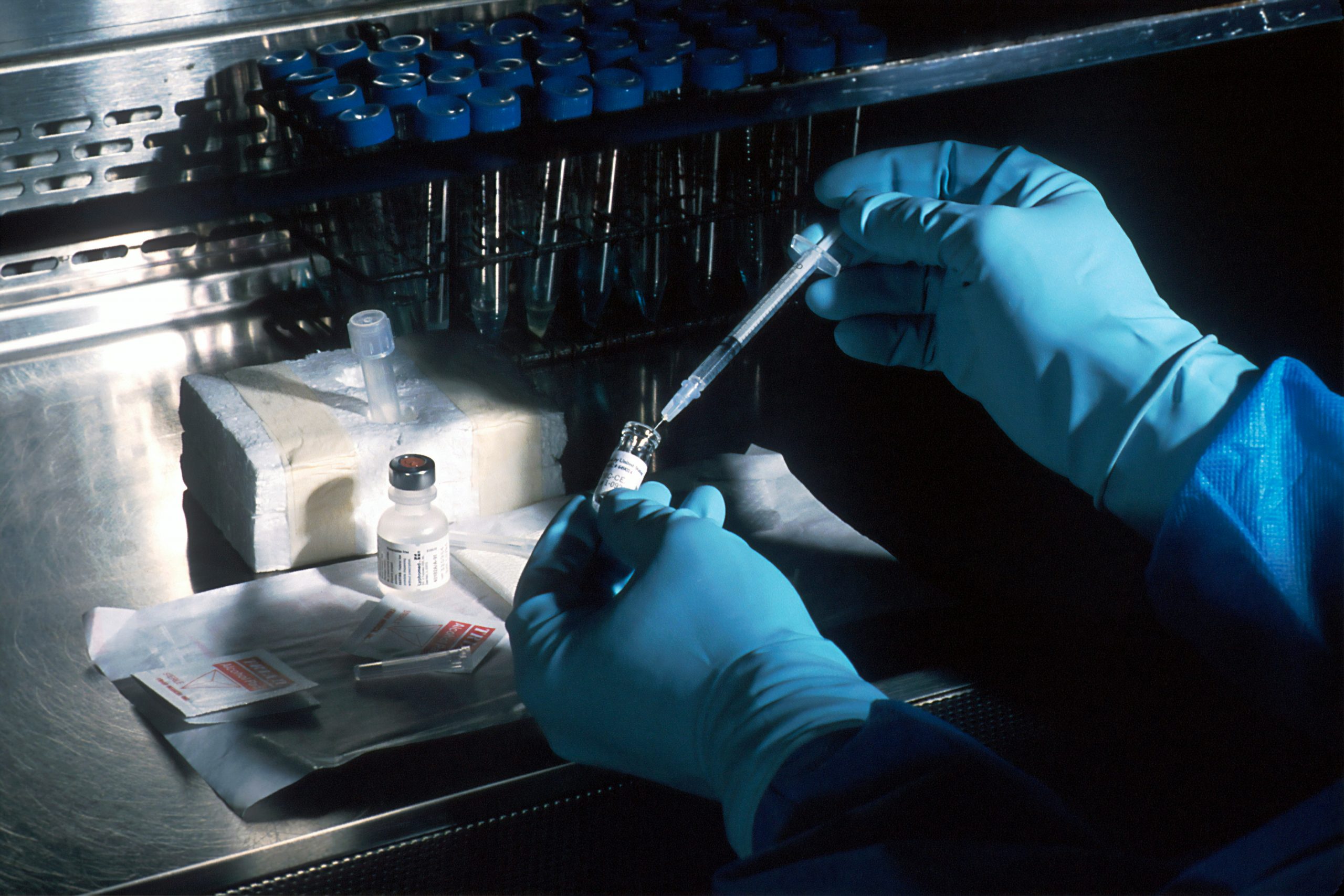 Hair Follicle Drug Testing for Addiction Monitoring