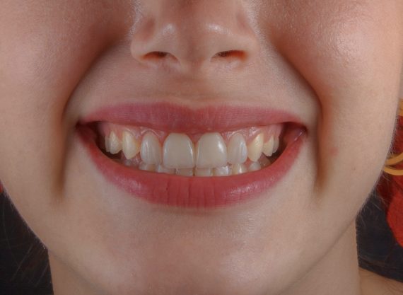 invisible orthodontics