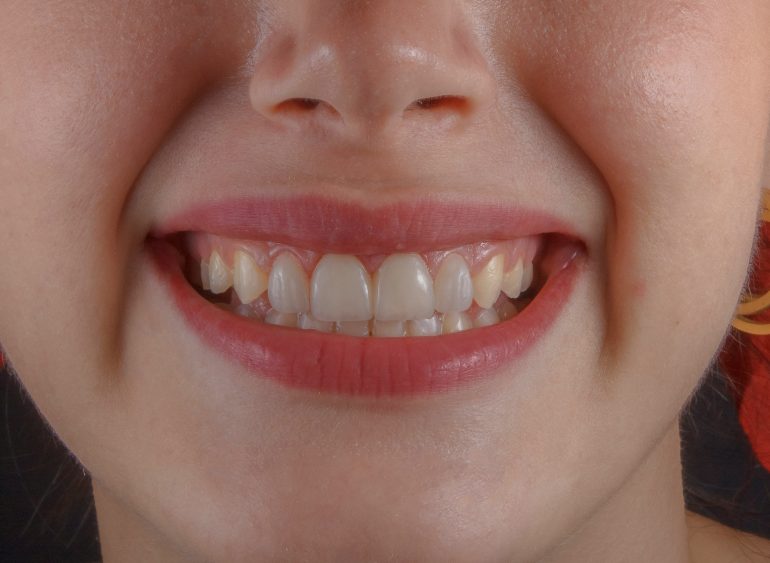 invisible orthodontics